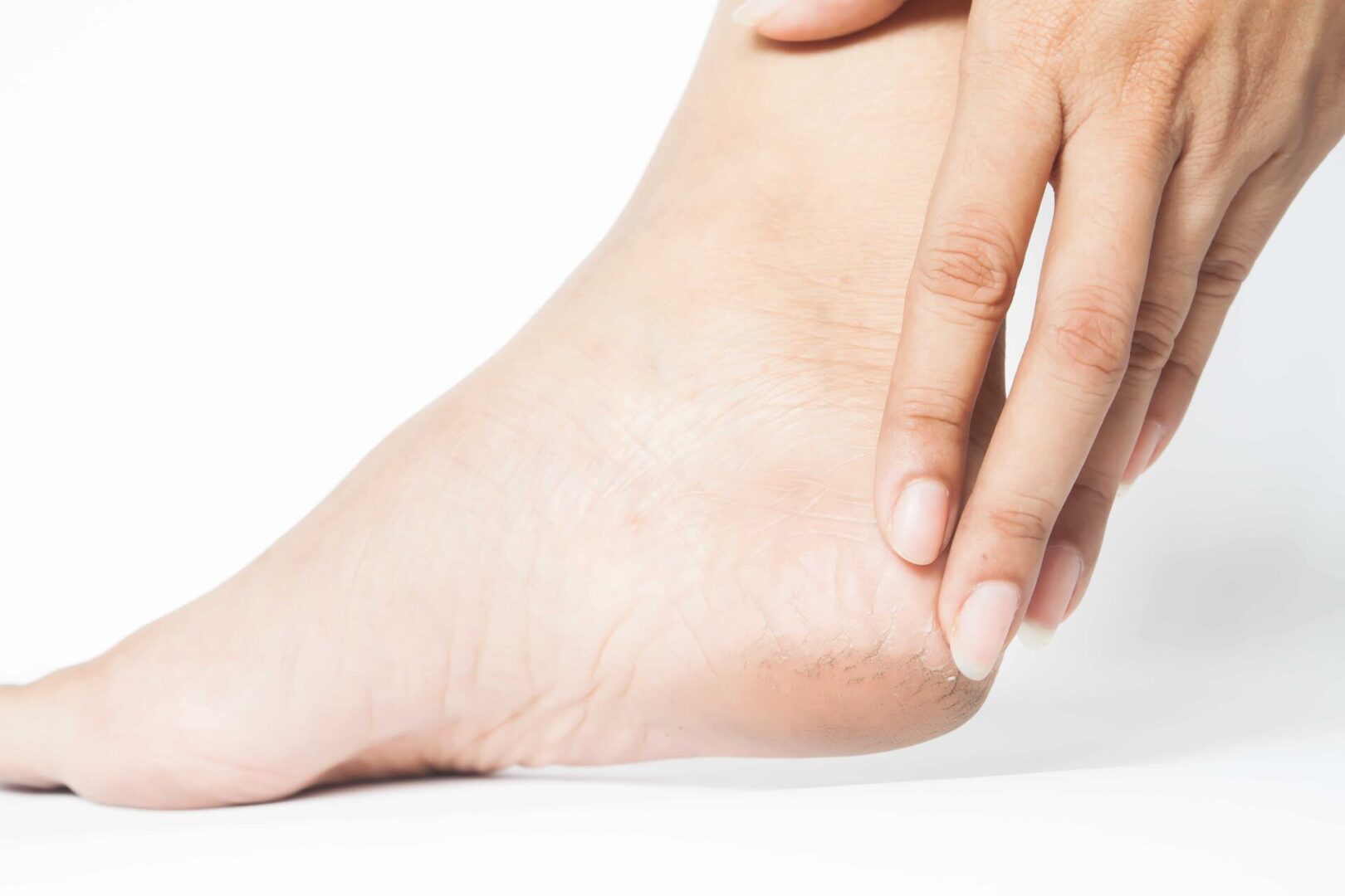 Effective Treatment for Dry Feet: Expert Tips and Solutions from a Chiropodist