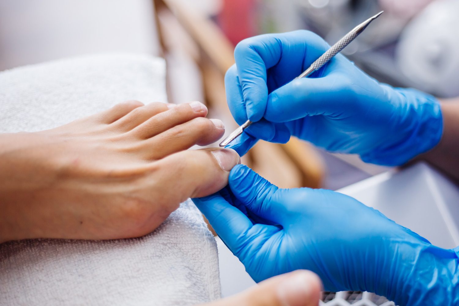 Signs Your Fungal Nail Infection Is Getting Worse